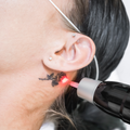 Laser Tattoo Removal Course COMING 2026